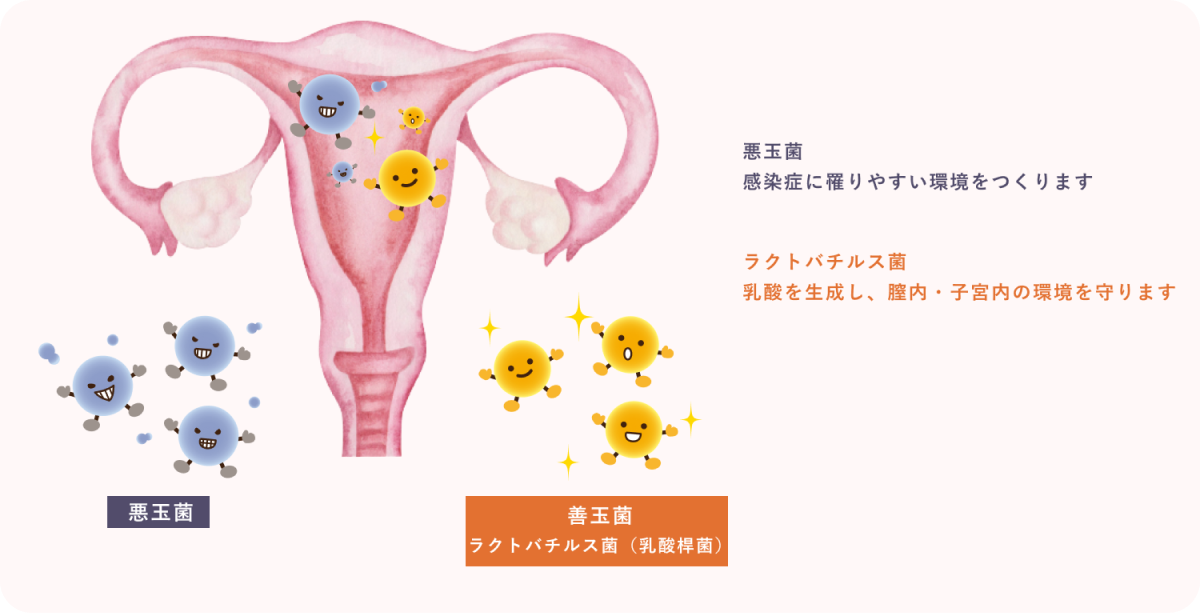 ラクとバチルスは乳酸を作って膣と子宮の環境を守りますの説明図